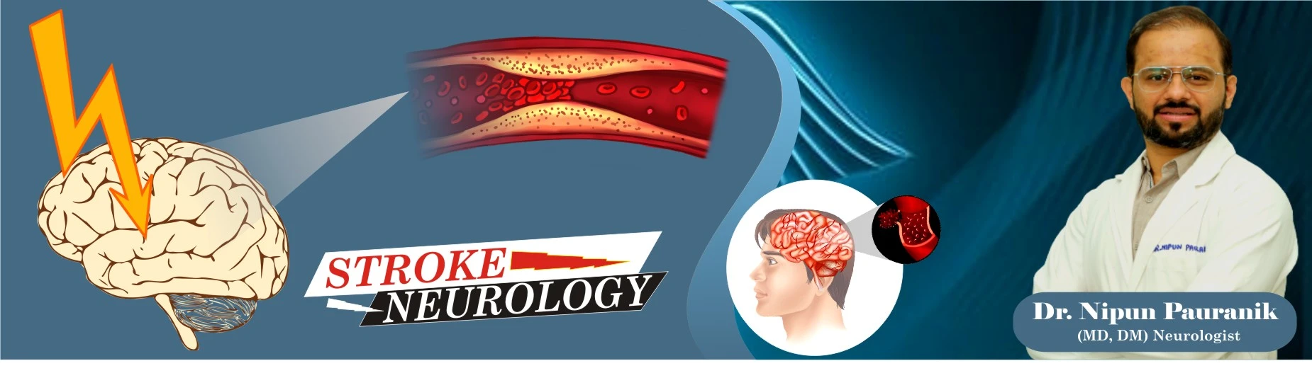 Internship Program for Stroke Neurology - Pauranik Academy of Medical Education